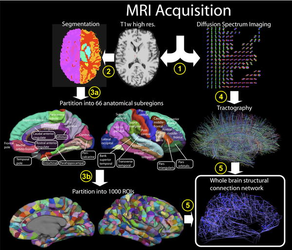 Cerebral Cortex And Its Millions Of Neural Fibers Gets A Map